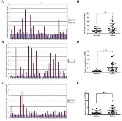 miR-93, miR-373, and miR-17-5p Negatively Regulate the Expression of TBP2 in Lung Cancer